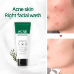 Some by mi Aha BHA PHA 30 Days Miracle Acne Clear Foam 100ml - Image 2