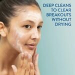 Cetaphil Gentle Clear Clarifying Acne Cream Cleanser 124ml - Image 2