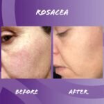 Edible Health Hydrolysed Bovine Collagen Powder – 400gm - Image 3