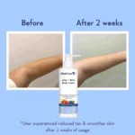 WishCare AHA + BHA Body Lotion 200ml - Image 3