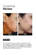 Minimalist Niacinamide 10% Face Serum 30ml - Image 5