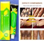 ESAPHARMA Lemonvate Cream 30g - Image 3